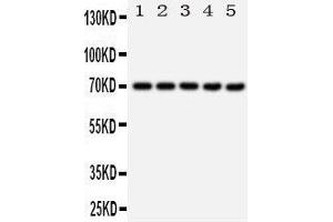 Western Blotting (WB) image for anti-Heat Shock 70kDa Protein 1A (HSPA1A) (AA 577-596), (C-Term) antibody (ABIN3044190) (HSP70 1A Antikörper  (C-Term))