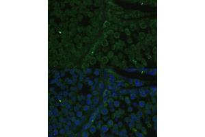 Immunofluorescence analysis of rat testis cells using IGF2BP2/IMP2 antibody (ABIN6131799, ABIN6142242, ABIN6142244 and ABIN6218878) at dilution of 1:100. (IGF2BP2 Antikörper  (AA 330-599))