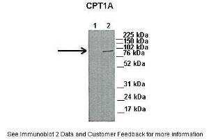 Lanes:   1. (CPT1A Antikörper  (Middle Region))