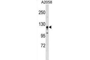 Western Blotting (WB) image for anti-serine/threonine Kinase 31 (STK31) antibody (ABIN3003073) (STK31 Antikörper)