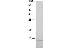 Western Blotting (WB) image for NADH Dehydrogenase (Ubiquinone) Fe-S Protein 6, 13kDa (NADH-Coenzyme Q Reductase) (NDUFS6) (AA 28-124) protein (His tag) (ABIN7124108)