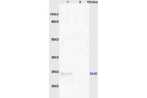Lane 1: mouse brain lysates Lane 2: mouse kidney lysates probed with Anti CHAC1 Polyclonal Antibody, Unconjugated (ABIN872557) at 1:200 in 4 °C. (CHAC1 Antikörper  (AA 131-222))