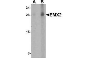 Western blot analysis of EMX2 in human lung tissue lysate with EMX2 Antibody at (A) 1 and (B) 2 µg/ml. (EMX2 Antikörper  (Middle Region))