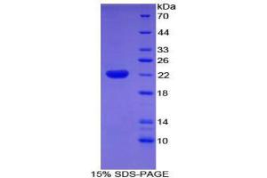SDS-PAGE (SDS) image for Cofilin 2 (CFL2) (AA 1-156) protein (His tag) (ABIN1879621)
