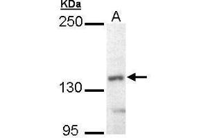 WB Image Sample (30 ug of whole cell lysate) A: Hep G2 , 5% SDS PAGE antibody diluted at 1:10000 (UBE4B Antikörper  (C-Term))
