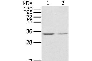 Western Blot analysis of NIH/3T3 and Jurkat cell using RACK1 Polyclonal Antibody at dilution of 1:300 (GNB2L1 Antikörper)
