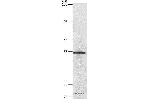 Western blot analysis of Lovo cell, using NEK2 Polyclonal Antibody at dilution of 1:727 (NEK2 Antikörper)