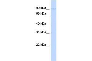 WB Suggested Anti-ZNF226 Antibody Titration:  0. (ZNF226 Antikörper  (N-Term))