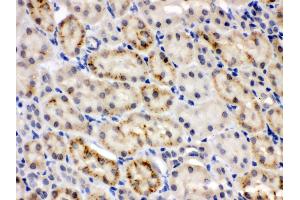 Anti- CRY2 Picoband antibody,IHC(P) IHC(P): Mouse Kidney Tissue (CRY2 Antikörper  (N-Term))