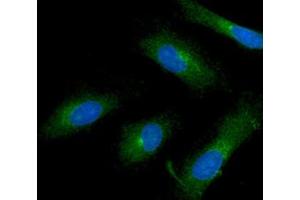 ICC/IF analysis of ISG15 in HeLa cells line, stained with DAPI (Blue) for nucleus staining and monoclonal anti-human ISG15 antibody (1:100) with goat anti-mouse IgG-Alexa fluor 488 conjugate (Green). (ISG15 Antikörper)