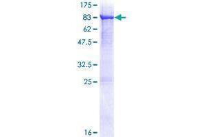 FSD1 Protein (AA 1-496) (GST tag)