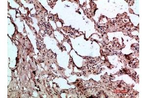 Immunohistochemical analysis of paraffin-embedded human-lung, antibody was diluted at 1:200. (GDF2 Antikörper  (AA 371-420))