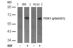 Western blot analysis of extracts from 293 and PC12 cells untreated or treated with EGF using PDK1(Phospho-Ser241) Antibody. (PDPK1 Antikörper  (pSer241))