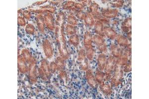 Used in DAB staining on fromalin fixed paraffin- embedded kidney tissue (Talin Antikörper  (AA 975-1181))