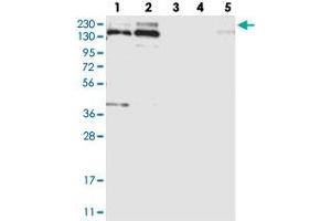 Western blot analysis of Lane 1: RT-4, Lane 2: U-251 MG, Lane 3: Human Plasma, Lane 4: Liver, Lane 5: Tonsil with SNRNP200 polyclonal antibody  at 1:250-1:500 dilution. (SNRNP200 Antikörper)