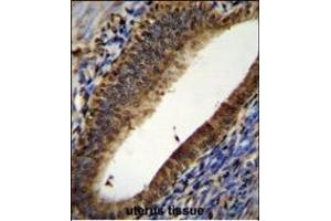 PT Antibody (N-term) (ABIN655715 and ABIN2845165) immunohistochemistry analysis in forlin fixed and paraffin embedded hun uterus tissue followed by peroxidase conjugation of the secondary antibody and DAB staining.
