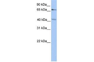 CHST13 antibody used at 1 ug/ml to detect target protein. (CHST13 Antikörper)