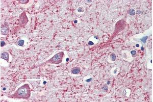 Immunohistochemistry (IHC) image for anti-Cytochrome P450, Family 26, Subfamily A, Polypeptide 1 (CYP26A1) (Internal Region) antibody (ABIN5539703)