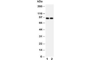 Western blot testing of MCM3 antibody and Lane 1:  HeLa;  2: Jurkat cell lysate. (MCM3 Antikörper  (N-Term))