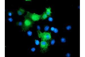 Anti-SMS mouse monoclonal antibody (ABIN2454723) immunofluorescent staining of COS7 cells transiently transfected by pCMV6-ENTRY SMS (RC200619). (SMS Antikörper)