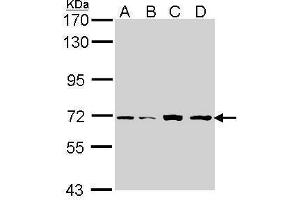 WB Image Sample (30 ug of whole cell lysate) A: H1299 B: Hep G2 , C: Molt-4 , D: Raji 7. (IRAK2 Antikörper)
