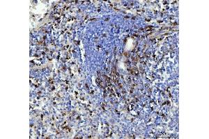 IHC analysis of CD90/Thy1 using anti-CD90/Thy1 antibody (ABIN5518877). (CD90 Antikörper  (AA 20-131))