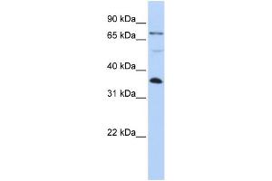 WB Suggested Anti-LASP1 Antibody Titration: 0. (LASP1 Antikörper  (C-Term))