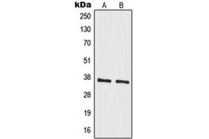 Western blot analysis of MRPS35 expression in A549 (A), HeLa (B) whole cell lysates. (MRPS35 Antikörper  (Center))