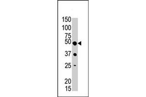 The PIGK polyclonal antibody  is used in Western blot to detect PIGK in mouse liver tissue lysate . (PIGK Antikörper  (C-Term))