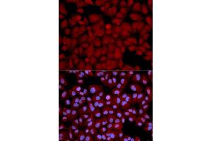 Immunofluorescence analysis of U2OS cells using PPP1CB antibody. (PPP1CB Antikörper  (AA 1-327))
