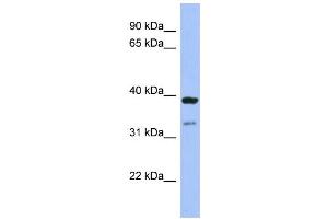 WB Suggested Anti-RASSF7 Antibody Titration:  0. (RASSF7 Antikörper  (Middle Region))