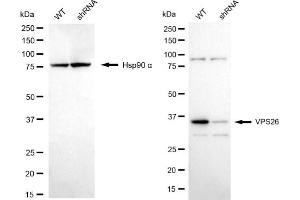 Western blotting analysis using VPS26 antibody (ABIN7800816).