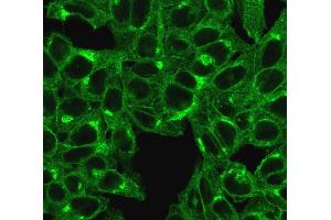 Immunofluorescent staining of HeLa cells. (beta-2 Microglobulin Antikörper)