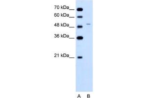 Western Blotting (WB) image for anti-Ferrochelatase (FECH) antibody (ABIN2462486) (FECH Antikörper)