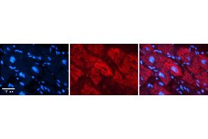 Rabbit Anti-NFATC1 Antibody    Formalin Fixed Paraffin Embedded Tissue: Human Adult heart  Observed Staining: Nuclear, Cytoplasmic Primary Antibody Concentration: 1:600 Secondary Antibody: Donkey anti-Rabbit-Cy2/3 Secondary Antibody Concentration: 1:200 Magnification: 20X Exposure Time: 0. (NFATC1 Antikörper  (N-Term))