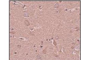 Immunohistochemistry of SRPX1 in human brain tissue with this product at 5 μg/ml. (SRPX Antikörper  (N-Term))