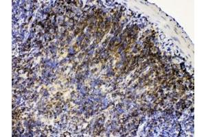 Immunohistochemistry (IHC) image for anti-V-Yes-1 Yamaguchi Sarcoma Viral Related Oncogene Homolog (LYN) (AA 470-501) antibody (ABIN5647656)
