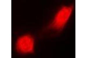 Immunofluorescent analysis of PSMC2 staining in MCF7 cells. (PSMC2 Antikörper)