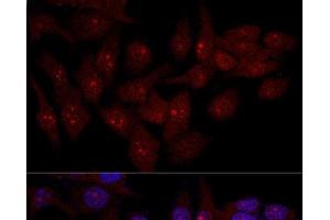 Confocal immunofluorescence analysis of Hela cells using EIF6 Polyclonal Antibody at dilution of 1:50. (EIF6 Antikörper)