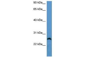 WB Suggested Anti-Frg1 Antibody Titration: 0. (FRG1 Antikörper  (Middle Region))