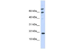 WB Suggested Anti-C21orf87 Antibody Titration:  0.