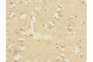 Immunohistochemistry of paraffin-embedded human brain tissue using ABIN7148480 at dilution of 1:100 (CNTNAP1 Antikörper  (AA 20-300))