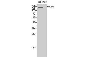 Western Blotting (WB) image for anti-Collagen, Type IV, alpha 2 (COL4A2) (N-Term) antibody (ABIN3184013) (COL4a2 Antikörper  (N-Term))