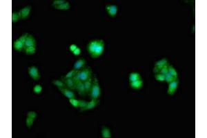 Immunofluorescent analysis of HepG2 cells using ABIN7153886 at dilution of 1:100 and Alexa Fluor 488-congugated AffiniPure Goat Anti-Rabbit IgG(H+L) (Glucocorticoid Receptor Antikörper  (AA 1-190))
