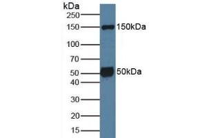 Detection of SGK1 in Mouse Brain Tissue using Polyclonal Antibody to Serum/Glucocorticoid Regulated Kinase 1 (SGK1) (SGK1 Antikörper  (AA 145-386))