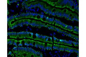 human duodenum (courtesy of L.