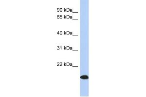 WB Suggested Anti-ARL17 Antibody Titration: 0. (ARL17 Antikörper  (Middle Region))