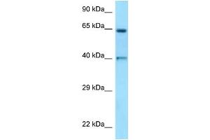WB Suggested Anti-ANGPT1 Antibody Titration: 1. (Angiopoietin 1 Antikörper  (N-Term))