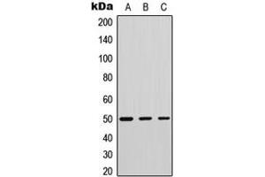 Western blot analysis of Phospholipase D4 expression in human tonsil (A), mouse testis (B), mouse muscle (C) whole cell lysates.