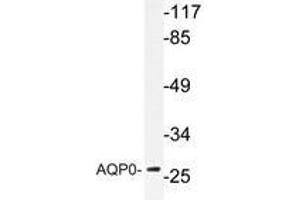 Western blot analysis of AP20629PU-N AQP0 antibody in extracts from HT-29 cells. (MIP Antikörper)